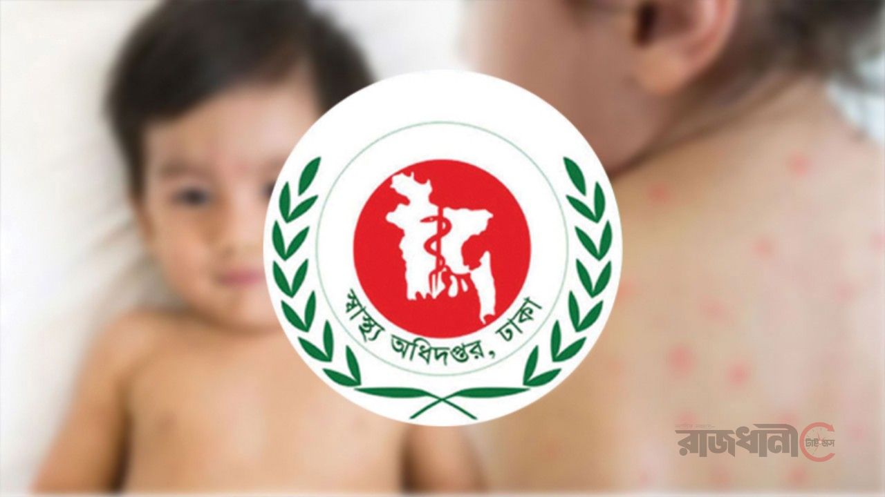 হামে আরও ৬ শিশুর মৃত্যু, শনাক্ত ছাড়াল ১৭ হাজার