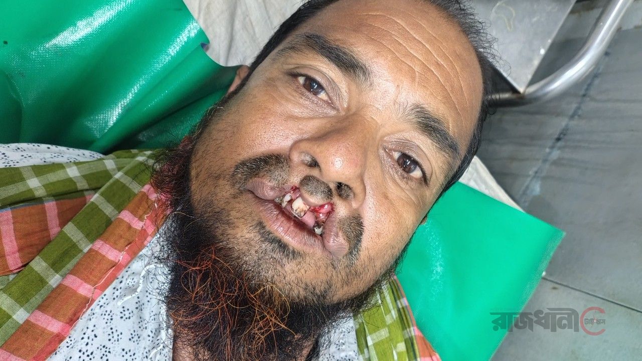 সালথায় আ.লীগ নেতাকে গ্রেপ্তার করায় বিএনপি নেতার দাঁত ভেঙ্গে দেওয়ার অভিযোগ